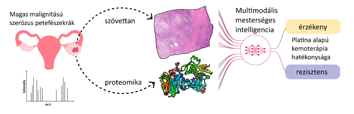petefészekrák kezelés mesterséges intelligencia támogatással